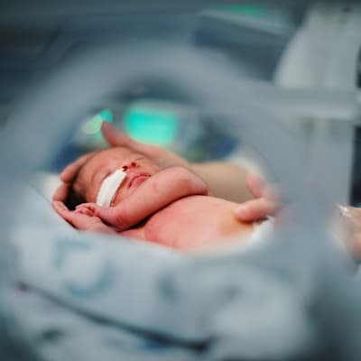 Premature baby at Children's Nebraska.